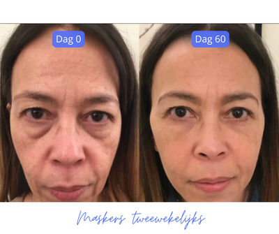 HyaluroLift MicroPatch